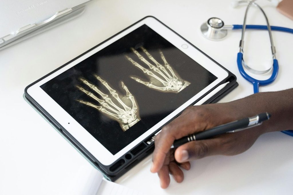 xray hands