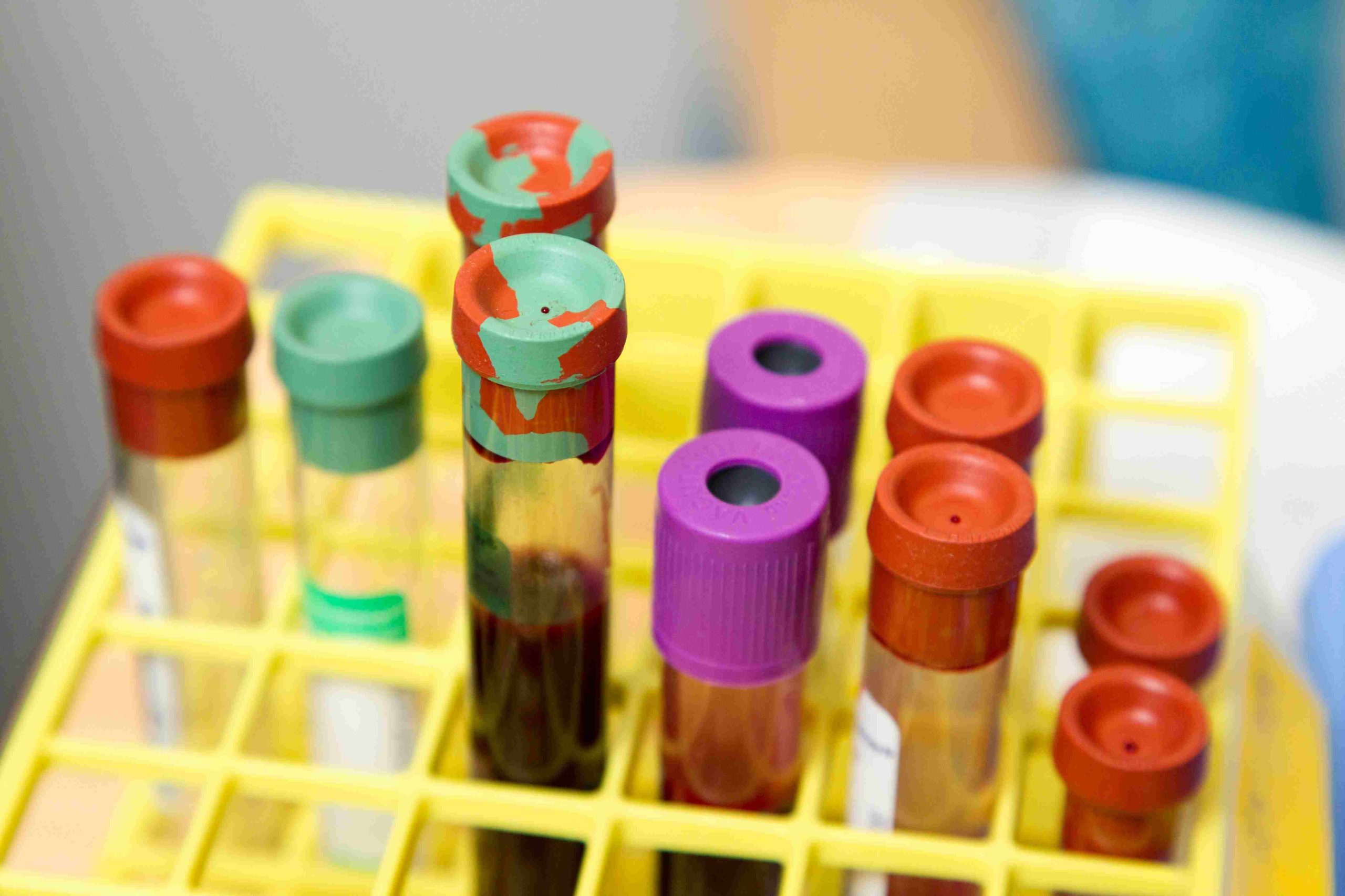 innovative startup tackles blood shortages with lab grown solutions