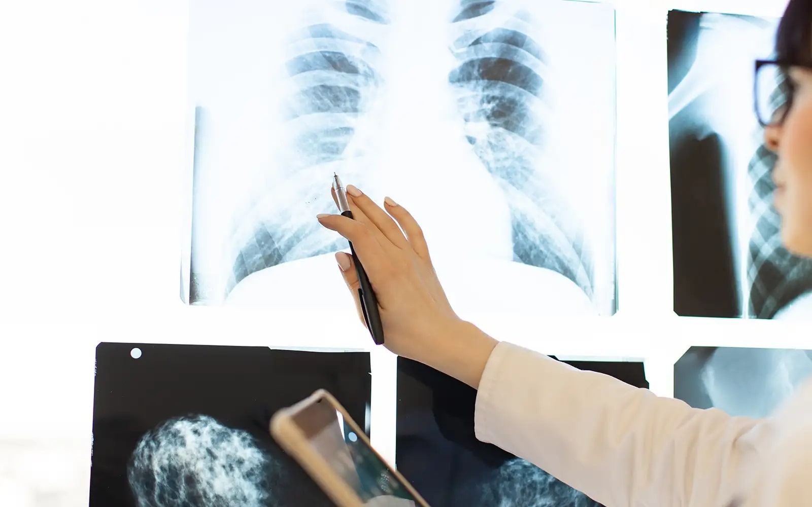 ai startup ataraxis raises funds to revolutionise cancer care