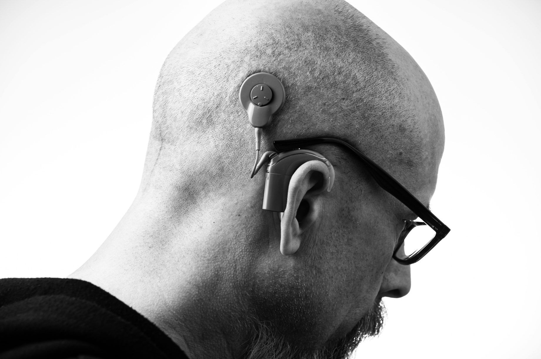 hearing loss