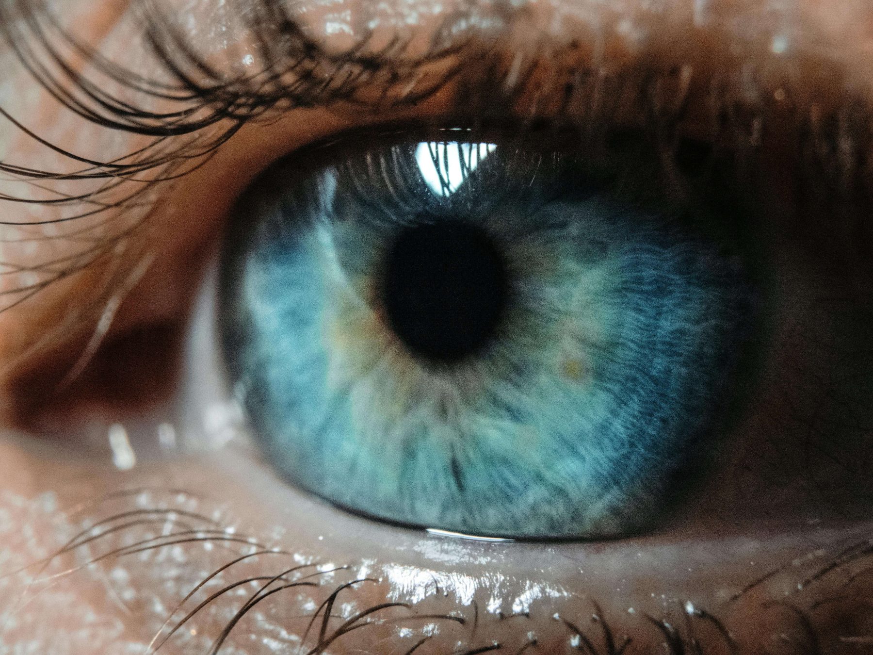 optic nerve (1)
